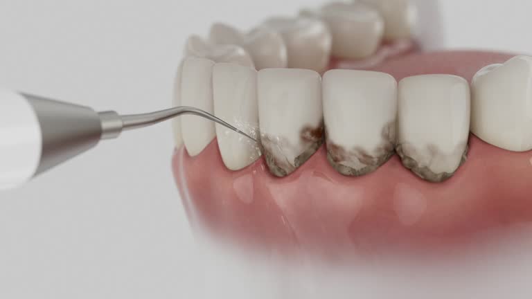 Reliable Dental Implants contractor in Mims, FL by Smile Center Dentistry
